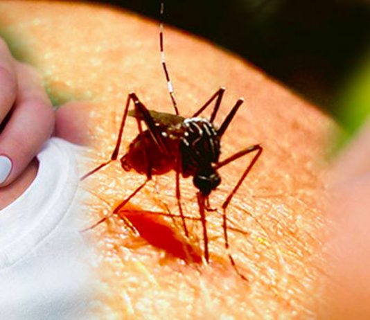 මදුරුවන් නිසා සමට ඇතිවෙන ආසාදන වළක්වාගන්නේ මෙහෙමයි…